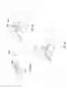 Fig. 07 - Catheter stabilization device and method of use