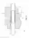 Fig. 06 - POST CERVICAL ARTIFICIAL INSEMINATION CATHETER
