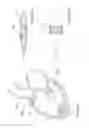 Fig. 63 - Inflatable medical devices