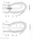 Fig. 65 - Inflatable medical devices