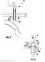 Fig. 03 - Vacuum assisted percutaneous appliance