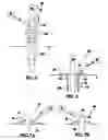 Fig. 04 - Vacuum assisted percutaneous appliance