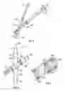 Fig. 04 - Systems and methods for intermittent infusion