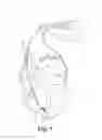 Fig. 02 - MEDICAL ELECTRICAL LEAD