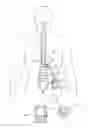 Fig. 01 - Lead with braided reinforcement
