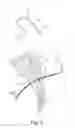 Fig. 06 - Lead with braided reinforcement