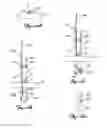 Fig. 13 - Tissue fixation and repair systems and methods