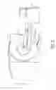 Fig. 03 - Surrogate implanted medical device for energy dissipation of existing implanted leads during MRI scans