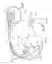 Fig. 15 - Surrogate implanted medical device for energy dissipation of existing implanted leads during MRI scans