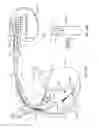 Fig. 18 - Surrogate implanted medical device for energy dissipation of existing implanted leads during MRI scans