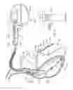 Fig. 19 - Surrogate implanted medical device for energy dissipation of existing implanted leads during MRI scans