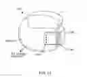 Fig. 34 - Surrogate implanted medical device for energy dissipation of existing implanted leads during MRI scans