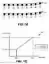 Fig. 03 - Fitting bilateral hearing prostheses