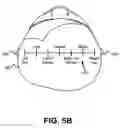 Fig. 07 - Fitting bilateral hearing prostheses