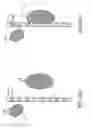 Fig. 22 - COLLECTION OF CLINICAL DATA FOR GRAPHICAL REPRESENTATION AND ANALYSIS
