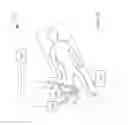 Fig. 12 - Electromagnetic radiation treatment