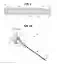 Fig. 02 - Medical device with radiation delivery