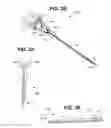 Fig. 03 - Medical device with radiation delivery