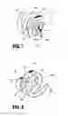Fig. 05 - Brachytherapy clip and applicator