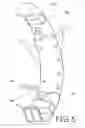 Fig. 04 - BODY ALIGNMENT AND CORRECTION DEVICE