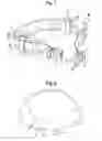 Fig. 06 - BODY ALIGNMENT AND CORRECTION DEVICE
