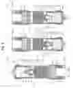 Fig. 06 - PRP extraction kit