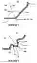 Fig. 04 - SCRAPING CLEANER