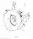 Fig. 05 - CLEANING MECHANISMS FOR CHECK VALVES