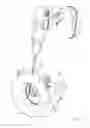 Fig. 08 - CLEANING MECHANISMS FOR CHECK VALVES