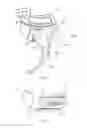 Fig. 06 - Force relieving mechanism and ratchet clamp having force relieving mechanism
