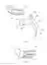 Fig. 09 - Force relieving mechanism and ratchet clamp having force relieving mechanism