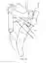 Fig. 12 - Multifunctional engineering accessory with 6-bar mechanism