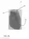 Fig. 16 - Method and Apparatus for Forming Blow Molded Vessels