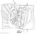 Fig. 04 - Axle wheel end axial thrust assembly