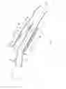 Fig. 02 - Refueling retainer