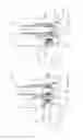 Fig. 04 - Vehicle mounted extender apparatus