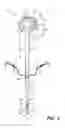 Fig. 03 - SAFETY APPARATUS AND METHOD FOR AN INFANT CARRIER
