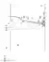 Fig. 09 - Float mooring method, mooring member, and method of recovering same