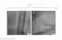 Fig. 14 - Method of manufacturing graphene using doped carbon materials