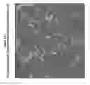 Fig. 04 - ATRASENTAN MANDELATE SALTS