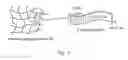 Fig. 02 - Beta sheet tapes ribbons in tissue engineering