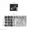Fig. 04 - RECOMBINANT POLYPEPTIDE FOR PROMOTING SCARLESS WOUND HEALING AND BIOADHESIVE MATERIAL INCLUDING THE SAME
