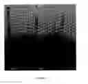 Fig. 06 - ANTI-INFLAMMATORY PROTEINS AND PEPTIDES AND METHODS OF PREPARATION AND USE THEREOF