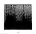Fig. 10 - ANTI-INFLAMMATORY PROTEINS AND PEPTIDES AND METHODS OF PREPARATION AND USE THEREOF