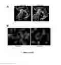 Fig. 12 - Mutant NGAL proteins and uses thereof