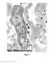 Fig. 16 - Mutant NGAL proteins and uses thereof
