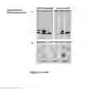 Fig. 29 - Mutant NGAL proteins and uses thereof