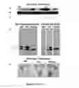 Fig. 42 - Mutant NGAL proteins and uses thereof