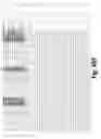Fig. 34 - Methods of treating cancer by administering IGF-IR binding molecules