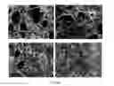 Fig. 26 - Alpha-synuclein antibodies and uses thereof